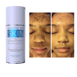 Admire My Skin - Ultra Potent Brightening Serum
