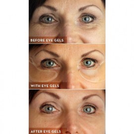 Eye Gels For Under Eyes and Crows Feet
