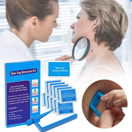 TagBand Skin Tag Remover Device